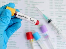 test kit for Syphilis testing