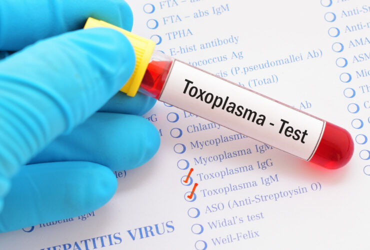 Visual Representation for Toxoplasmosis testing | Credits: Shutterstock