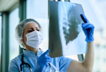 San Diego Health authorities warn of potential TB exposure