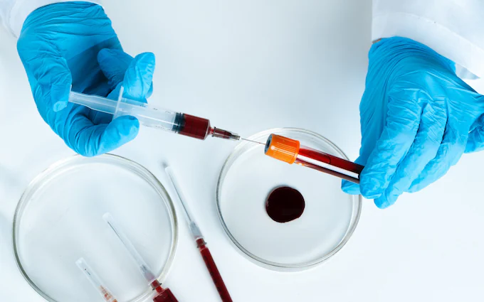 Hepatitis C Infections Uncovered in Contaminated Blood Scandal